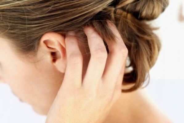 Mâncărimea insuportabilă a scalpului este un semn al psoriazisului în stadiul acut