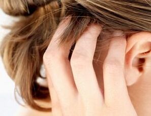 semne și simptome ale psoriazisului pe scalp